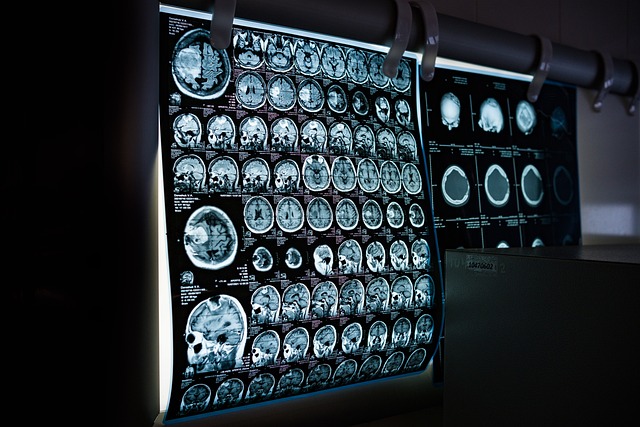MRI z kontrastem